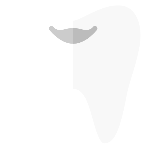 ホームホワイトニング